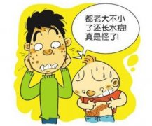 蘇州國(guó)醫(yī)堂郭福新(xīn)：引起帶狀疱疹的因素有哪些？