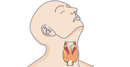 什麽食物(wù)會導緻甲狀腺結節？蘇州如何治療此病？