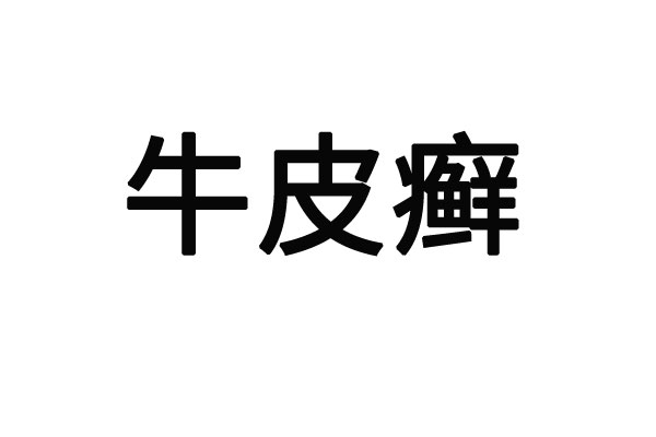 蘇州中醫(yī)治療牛皮癬的醫(yī)院哪家好？